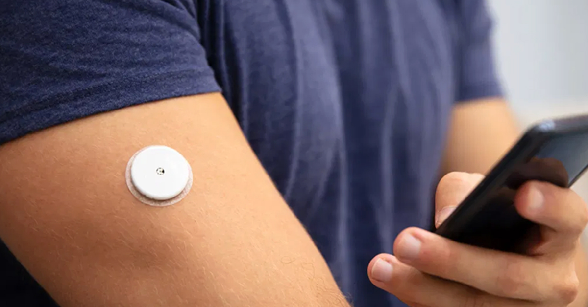 Read more about the article 世界の持続グルコースモニタリング市場、2031年317億米ドル